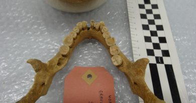 Dientes mediales