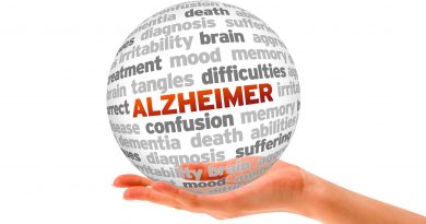 enfermedad de Alzheimer
