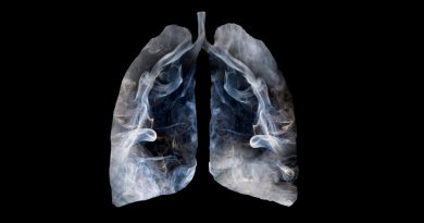 Radiografía de pulmones afectados por el tabaco.